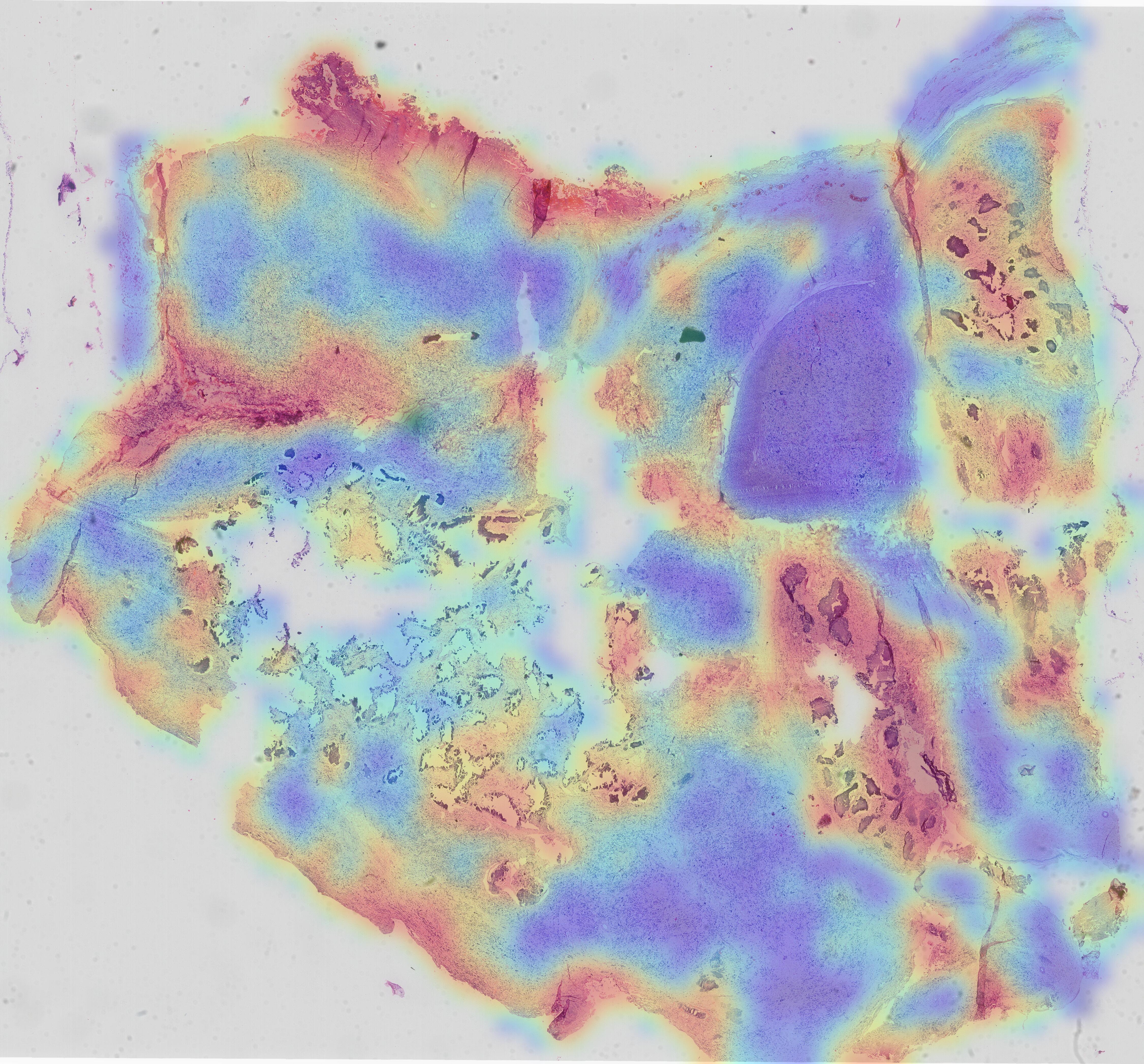 heatmap